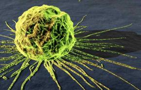 انجاز جديد للعلماء الايرانيين في علاج الخلايا السرطانية