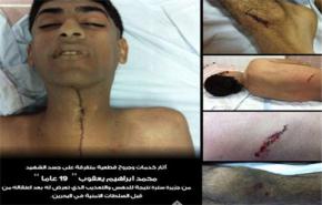 سلطات البحرين تمارس التعذيب الممنهج بحق المتظاهرين
