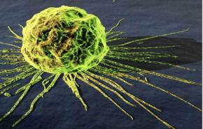 الناجون من السرطان يموتون بسبب أمراض أخرى