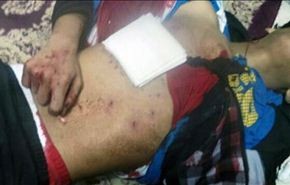 استشهاد الطفل حسين الجزيري بأيدي الأمن البحريني