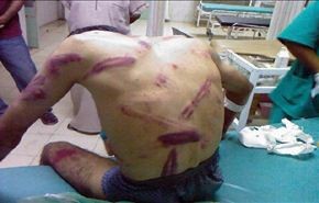 تعذيب المعتقلين بالبحرين يؤكد عدم وجود ادلة ضدهم
