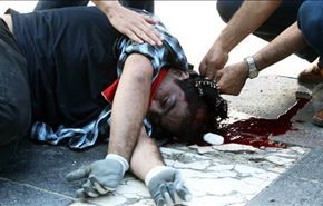79 زخمی در درگیرهای مردم ترکیه با پلیس
