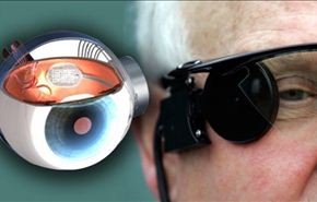 “العين الإلكترونية”: فرصة جديدة للمصابين بالعمى