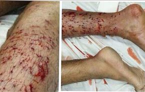 تیراندازی به بحرینی ها از فاصله 4 متری
