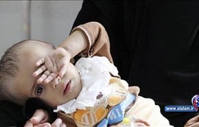 تقرير أممي: نصف اليمنيين يعانون الجوع والبطالة