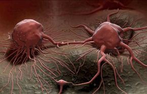 العلماء يجعلون خلايا السرطان تدمر نفسها بنفسها