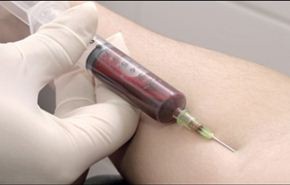 الاطباء: فحص للدم يحدد كم تبقى من العمر