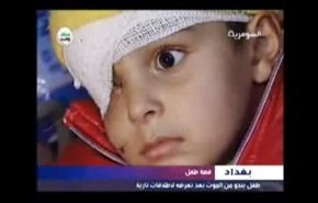 فيديو/ الارهاب يطلق الرصاص على طفل عراقي ويسلبه إحدى عينيه
