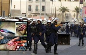 صور/الامن البحريني يعذّب معتقلين بالأمواس وأعواد السجائر