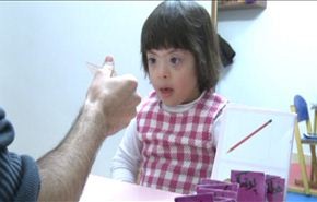 كيف نتعامل مع المصابين بمتلازمة داون