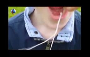 بالفيديو .. طفل يقلع ضرسه بواسطة طائرة
