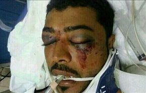 27 يوما على احتجاز نظام البحرين لجثة الشهيد العبار