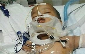 نجات کودک 15 ماهه‌ای که از طبقه یازدهم سقوط کرد + عکس