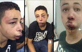 شاهد بالفيديو كيف تضرب قوات الاحتلال طفلا فلسطينيا