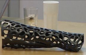 طابعات ثلاثية الابعاد لمعالجة کسور العظام