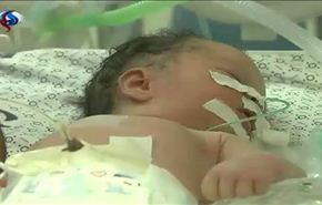 أطباء غزة يستخرجون طفلة حية من بطن أمها بعد استشهادها+فيديو