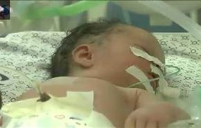 نجات یک جنین از زیر آوار در غزه + فیلم