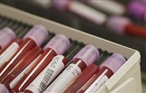 انیمیا الخلایا الجذعية