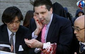 فيديو وصور..إصابة السفير الأميركي في سيئول بجروح في هجوم
