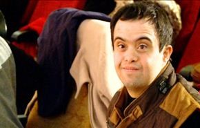 متلازمة داون