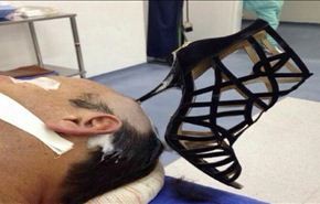 صورة... كعب حذاء يستقر في رأس رجل ضربته به زوجته