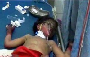 فيديو+ صور/ ضحايا القصف السعودي لليمن بينهم أطفال