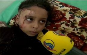 خاص؛ حروق اجساد اطفال اليمن عبر كاميرا العالم