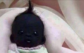 عجیب ترین کودک سیاه پوست جهان + عکس