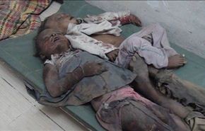 السعودية ترتكب مجزرة اخرى بلحج معظم ضحاياها أطفال