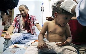 اكثر من مئة قتيل وجريح بالعدوان السعودي على اليمن