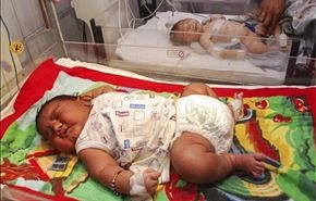 تصاویر تولد نوزاد 5.8 کیلوگرمی در هند