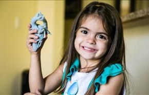 طابعة ثلاثية الأبعاد تنقذ قلب طفلة