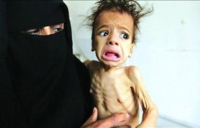 یونیسف:نیم میلیون کودک یمنی درمعرض قحطی