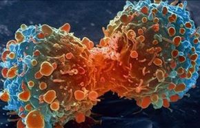 4 مهن تحفز الأورام السرطانية