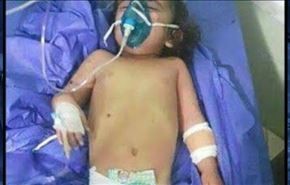 مرگ دختر عراقی در حمله شیمیایی داعش