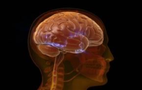 الجلطة الدماغية وتبعاتها الصحية
