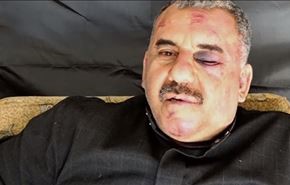 بالفيديو؛ آثار الضرب والتعذيب على الطيار السوري في حلب
