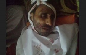 اغتيال قيادي اخواني بارز بمدينة ذمار اليمنية