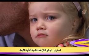 استراليا.. ابداع آذان اصطناعية ثلاثية الابعاد