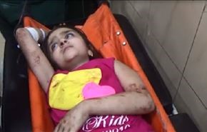 الارهاب يستنزف مدنيي حلب بقذائف الموت، ماذا عن الحسم العسكري؟