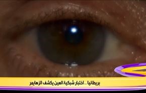 بريطانيا.. اختبار شبكية العين يكشف الزهايمر