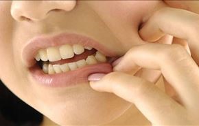 کشیدن دندان با هلی کوپتر+ عکس