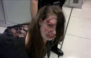 فتاة ضربها الأمن ضربا مبرحا... ليكتشفوا المفاجأة!+صورة