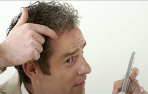 إليكم أفضل 6 طرق لمكافحة تساقط الشعر