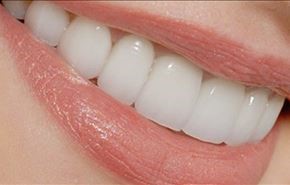 نسخه جادویی آسان برای داشتن دندان های سفید