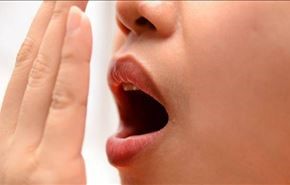 دراسة جديدة..إليكم سبب رائحة الفم الكريهة والحلول