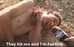 فيديو غريب .. شاهد ماذا فعلت صحفية مع رجل صدمته سيارة؟!