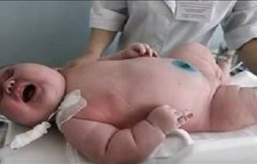 فيديو... ولادة أضخم رضيع في العالم