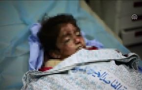استشهاد طفلة فلسطينية دهسها مستوطن إسرائيلي بالضفة