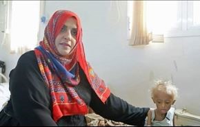پزشک زن یمنی که با قحطی می‌جنگد